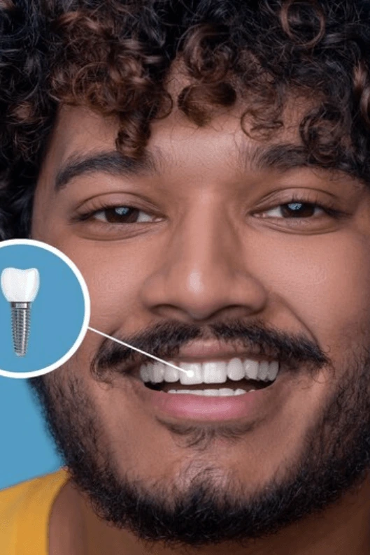 Restore Permanently. Smile Confidently: Premium Dental Implants