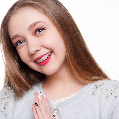 Who to get braces from?