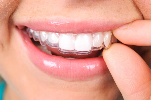 Clear aligners