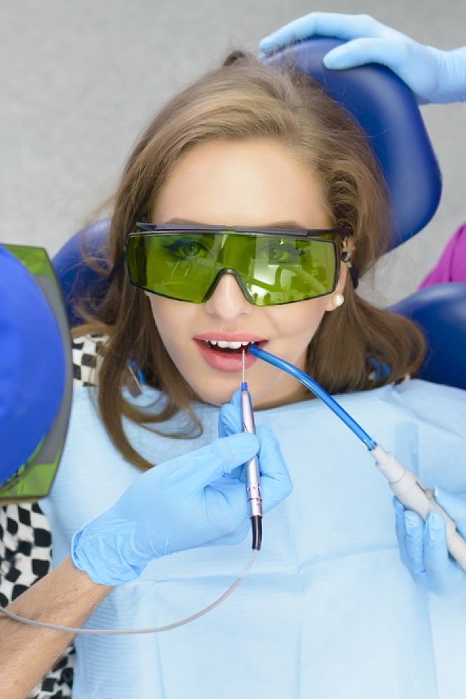 Laser Veneer Removal