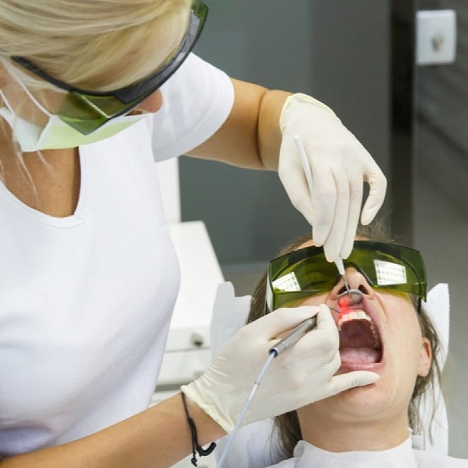 About Laser Veneer Removal