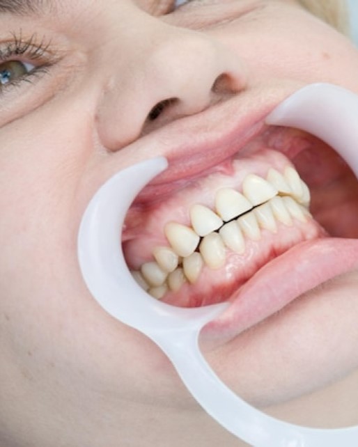 Why Choose Dr. Aburas Dental Center