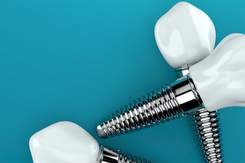 Worried about dental implant surgery Pain?