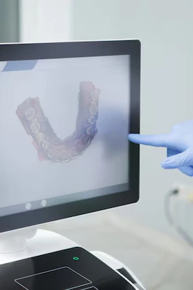 About Dental Digital Scan at Dr. Aburas Dental Center