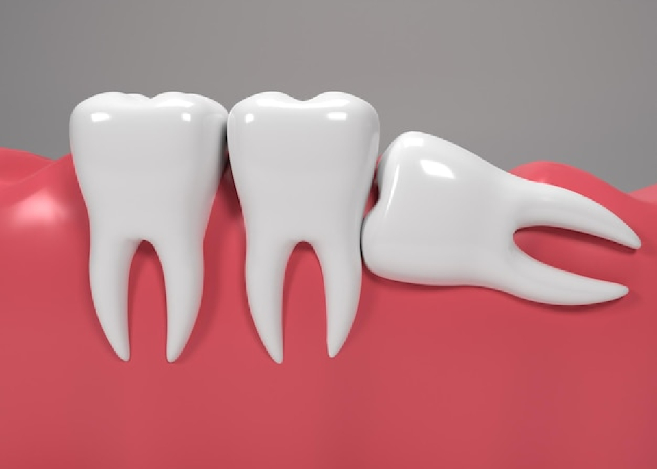 Related Treatments & Surgical Services