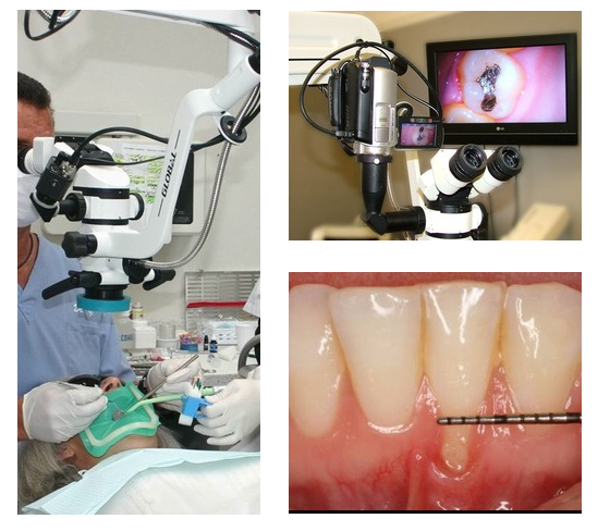 What is Microscopic Dentistry