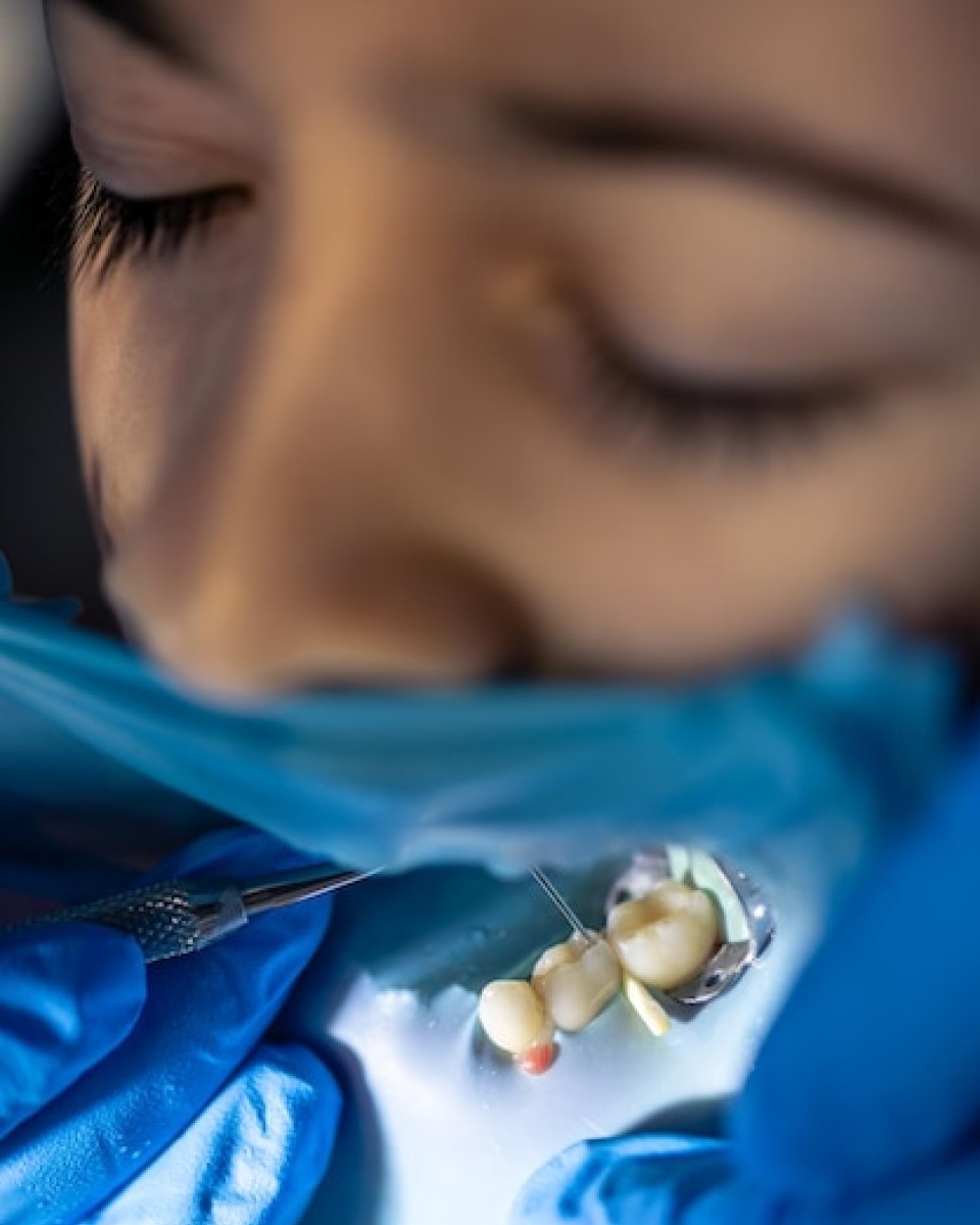 Why Choose Dr. Aburas Dental Center